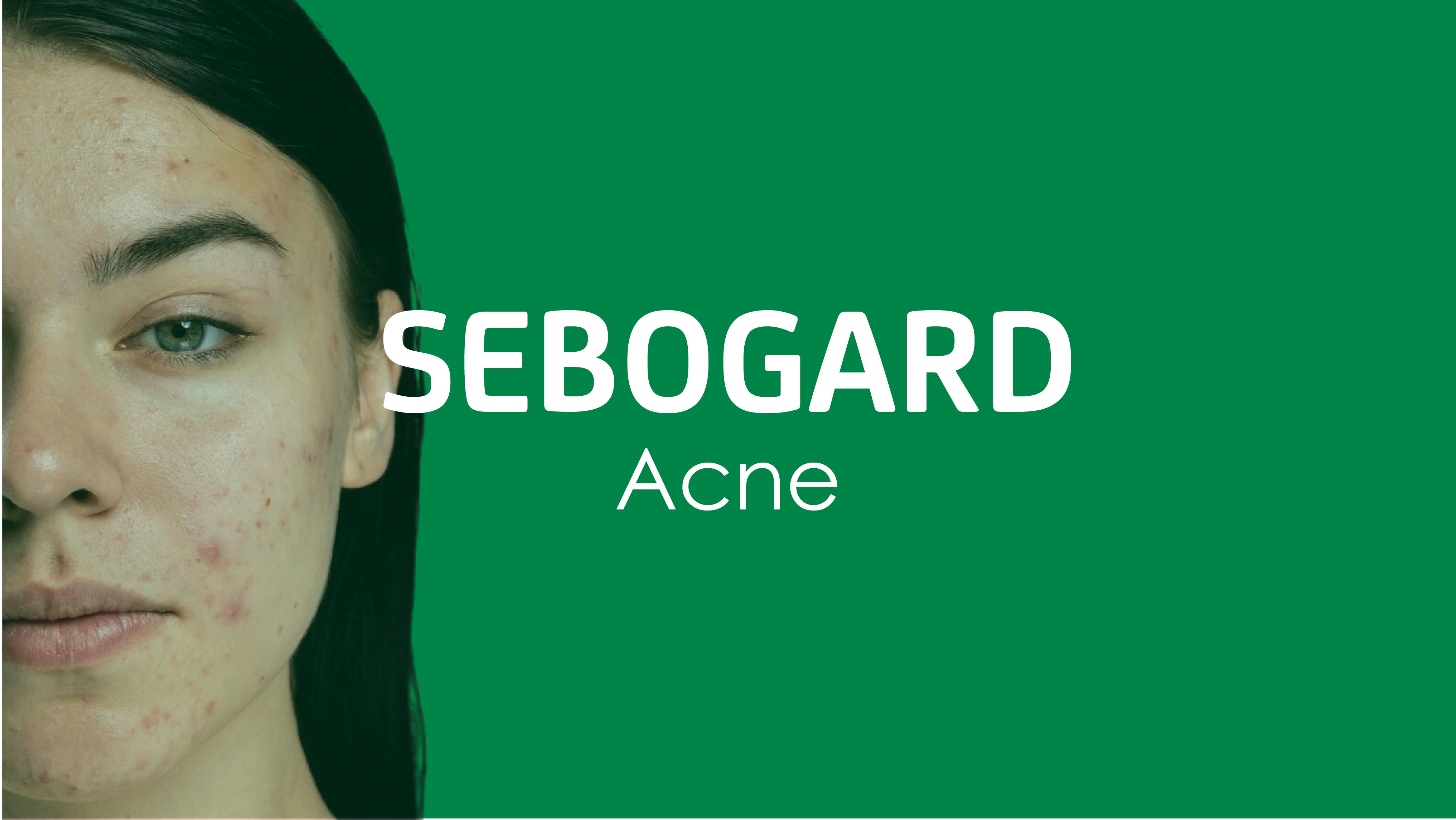 Acne Treatment Products | Difa Cooper Jordan